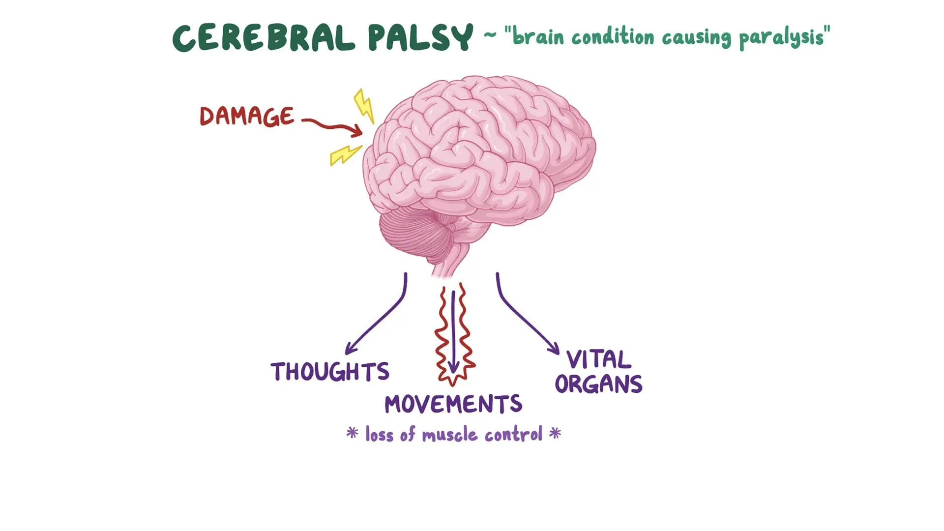 Rehabilitation of cerebral palsy