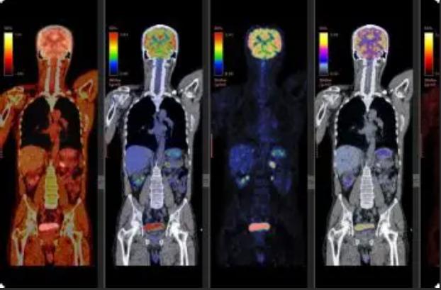 PET CT