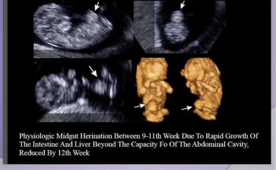 Fetal Alimentary canal
