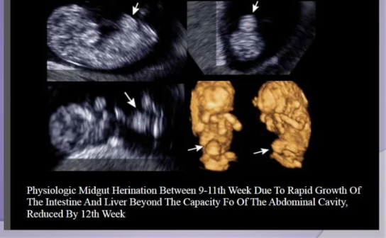 Fetal Alimentary canal